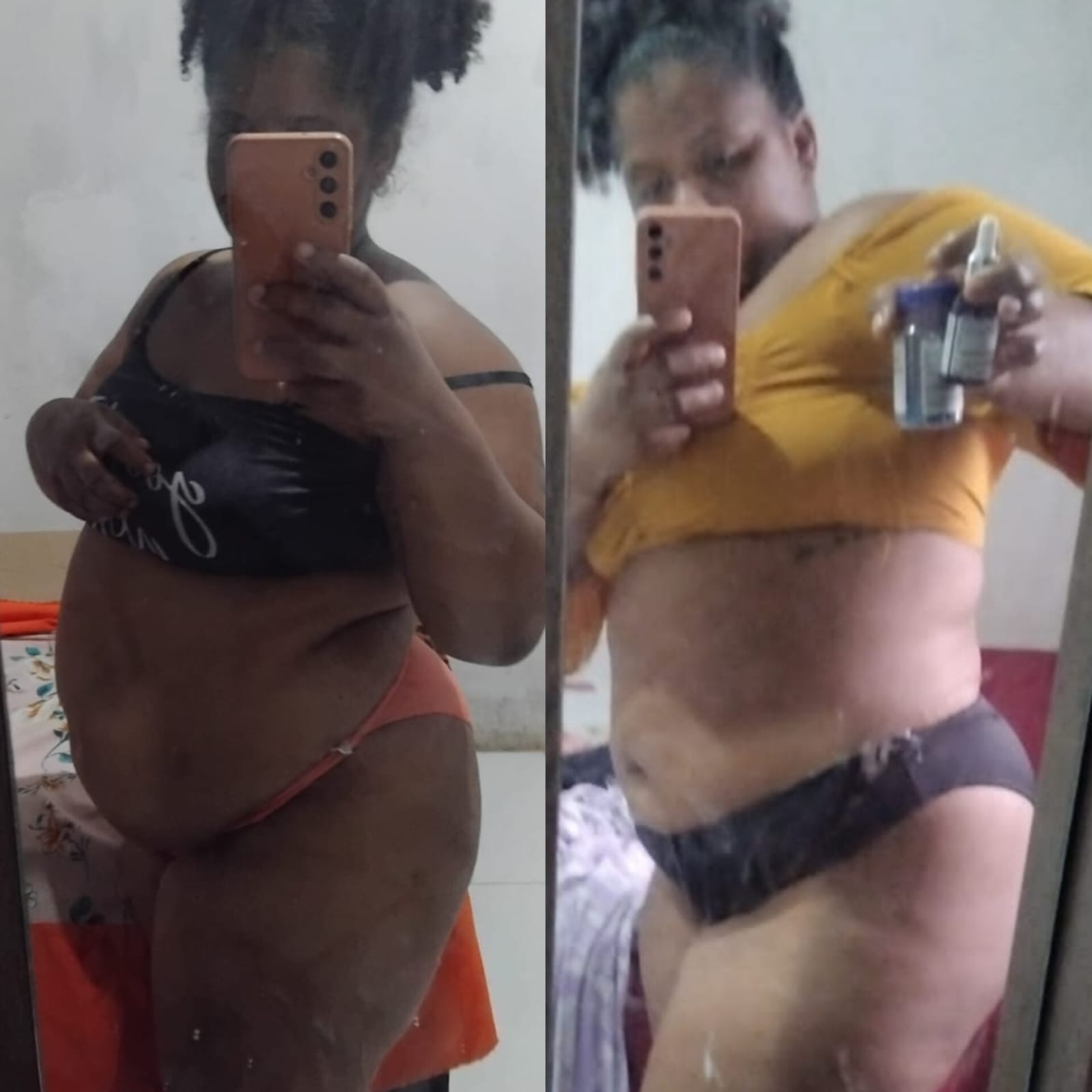 Resultado de emagrecimento com Ozenvitta — redução de gordura na barriga