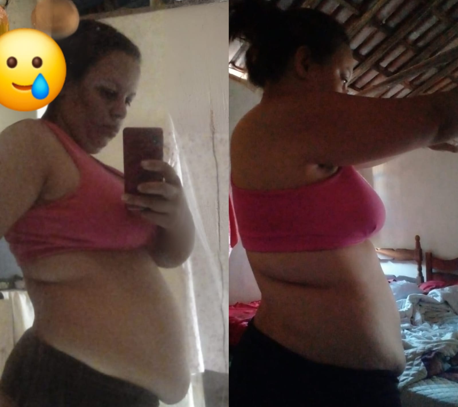 Depoimento e evolução de Laianne com Ozenvitta antes e depois